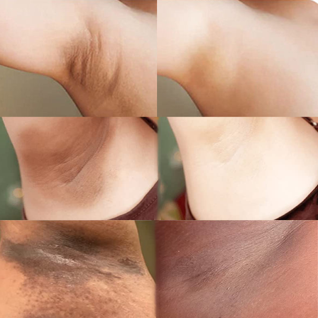 Halal high quality No Side Effects instant skin whitening body lotion armpit underarm whitening cream for women