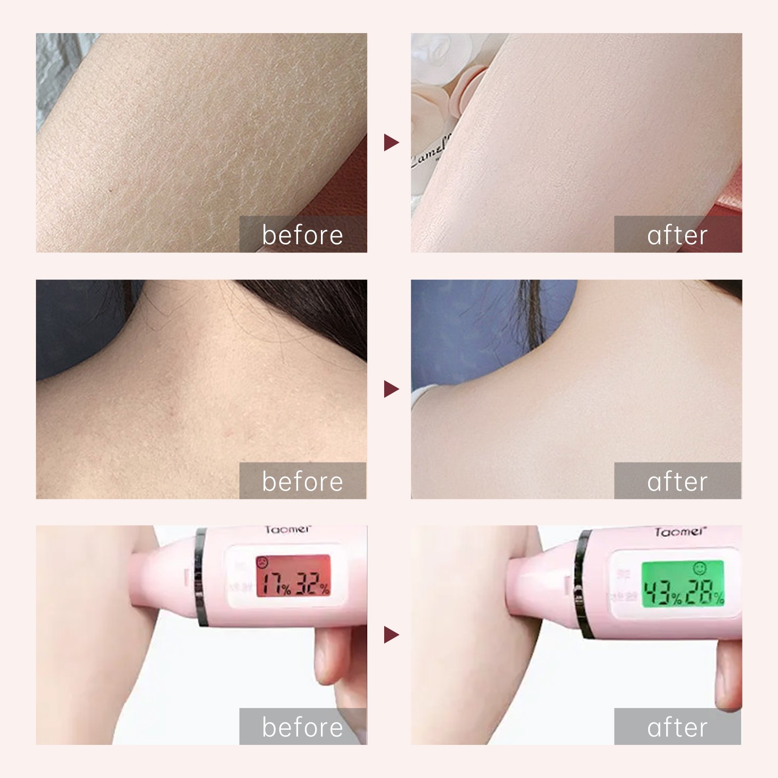 AuQuest OEM Private label organic Long Lasting Deep Moisturiser Remove Spots Corrector Strong Remover Black body lotion