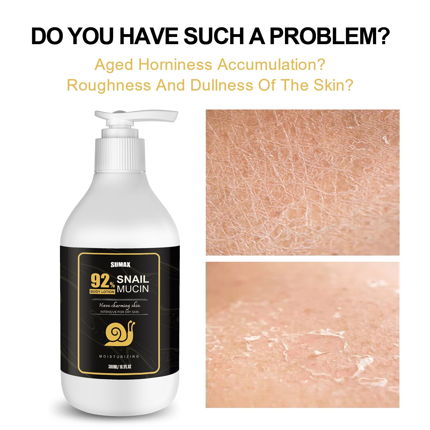 Sumax 300ml Wholesale Snail White Body Lotion For Women Men Body Skin Care