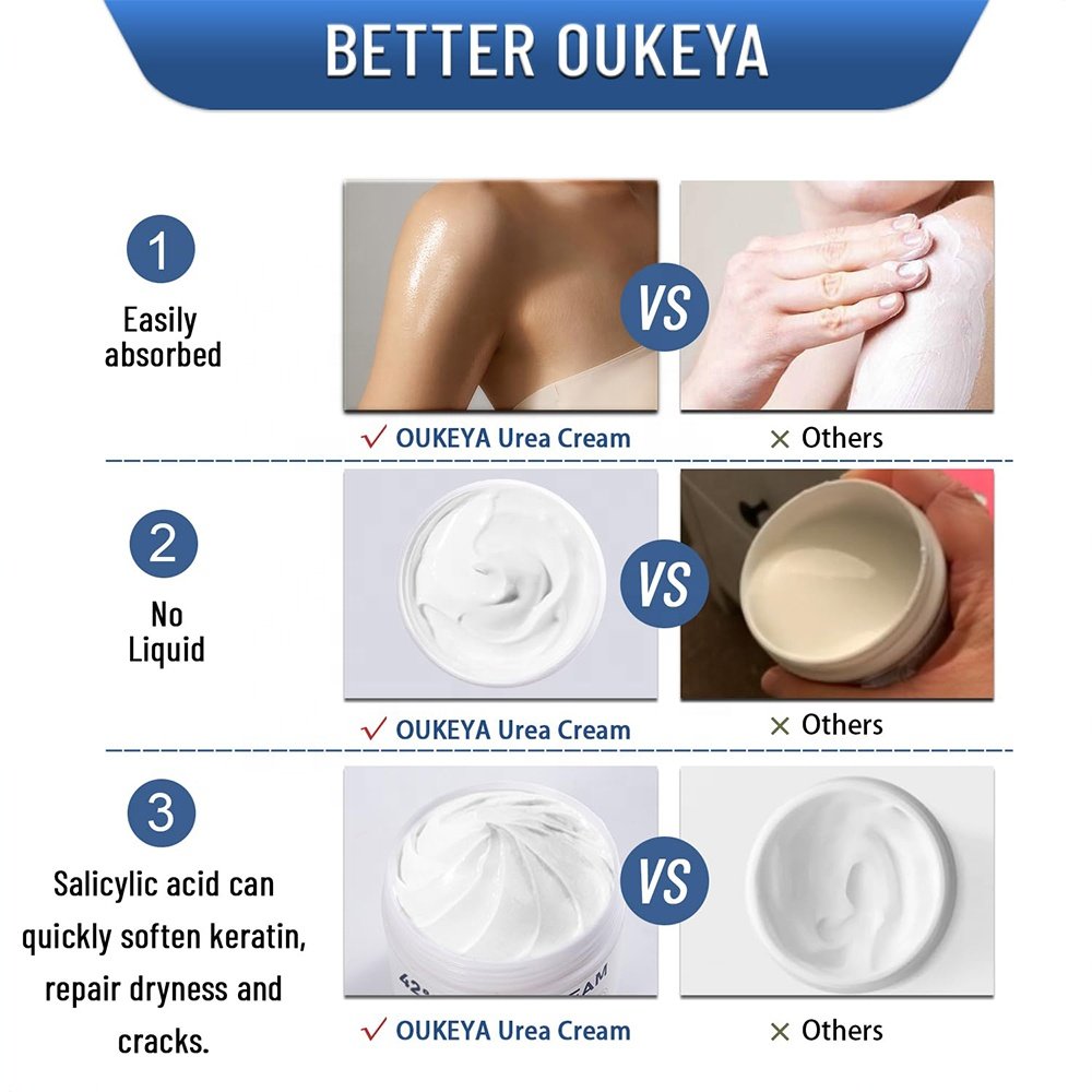 Wholesale OEM/ODM Private Label Body Urea Cream&Lotion for Feet Hand Bulk Repair Dry Cracked Skin Urea Foot Cream