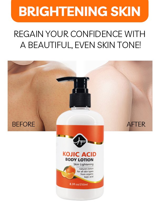 Wholesale Private Label Kojic Acid Body Lotion niacinamide Organic Dark Skin Brightening Whitening Body Lotion For Black Skin