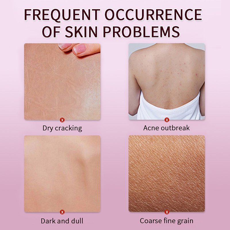 Wholesale Long-lasting Moisturizing Barrier Repair Whitening Body Lotion Niacinamide