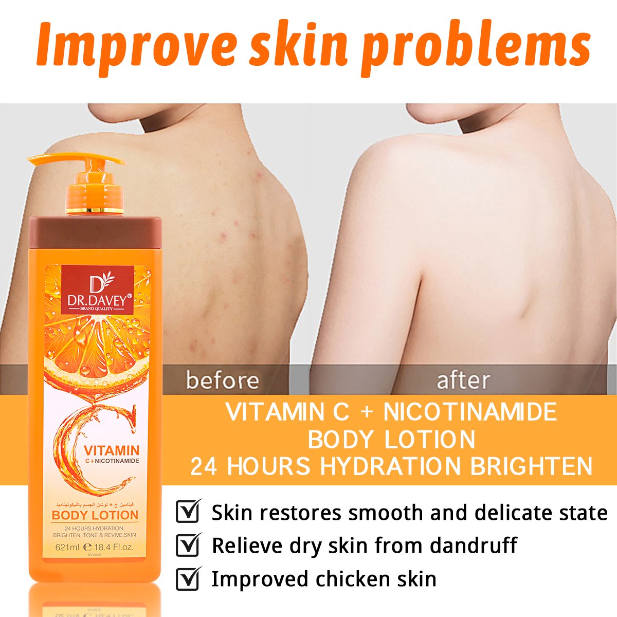 DR.DAVEY VC NICOTINAMIDE BODY LOTION Nourishing Exfoliator Lightening For All Skin