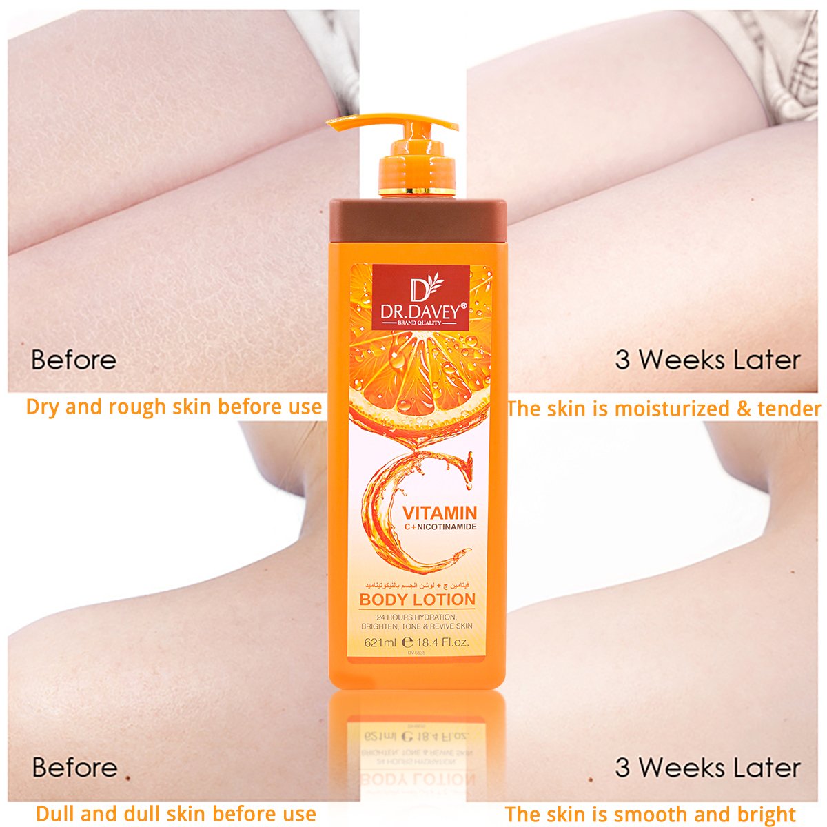 DR.DAVEY VC NICOTINAMIDE BODY LOTION Nourishing Exfoliator Lightening For All Skin