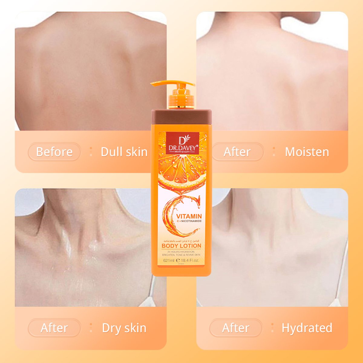 DR.DAVEY VC NICOTINAMIDE BODY LOTION Nourishing Exfoliator Lightening For All Skin