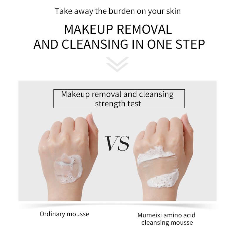 Professional Body Lotion For Dry Skin Use Daily Women Repair Moisturizing Damage Dark Skin Urea Vitamin E Skin Repair Lotion