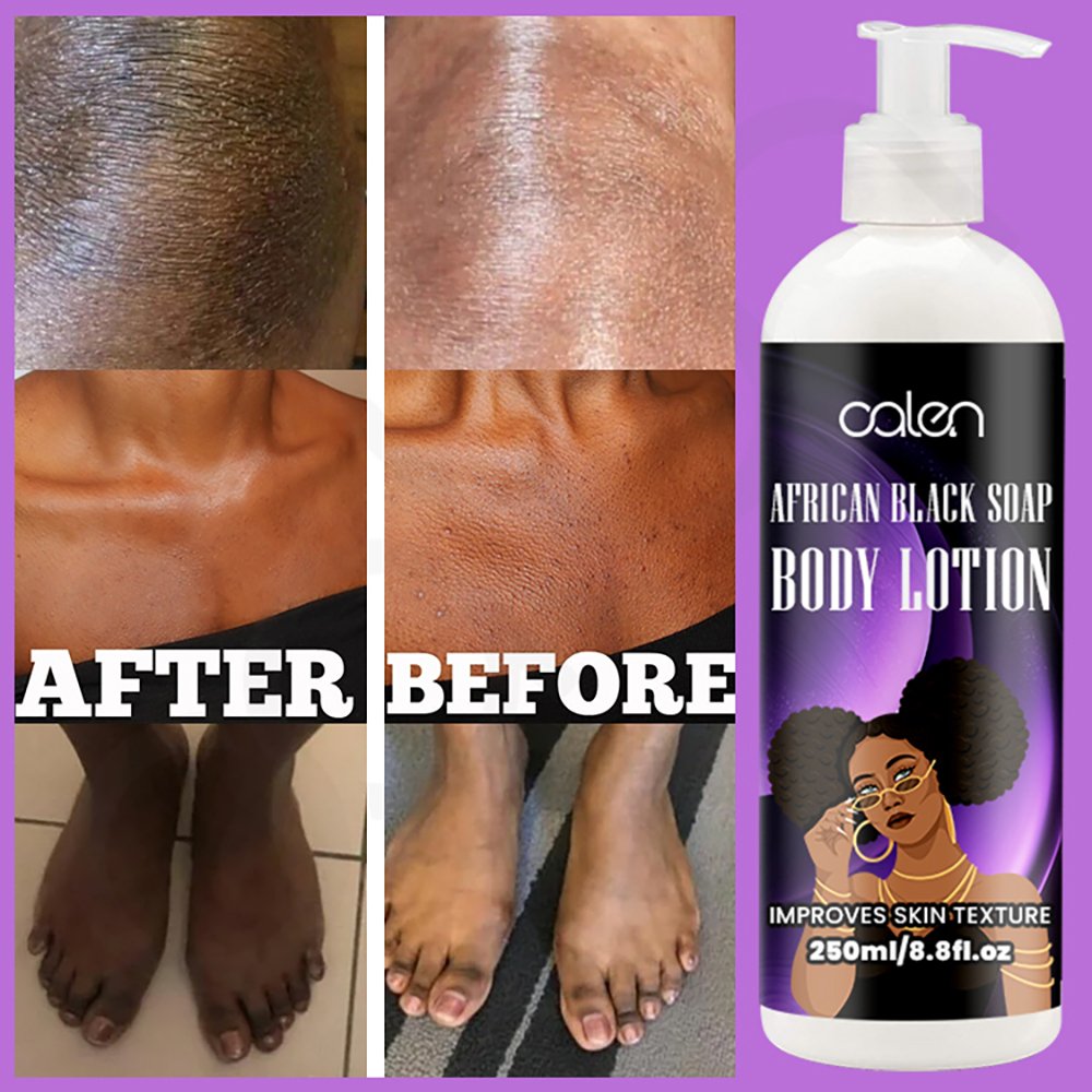 Oalen 250Ml Private Label Herbal Improves Skin Texture African Black Soap Body Lotion