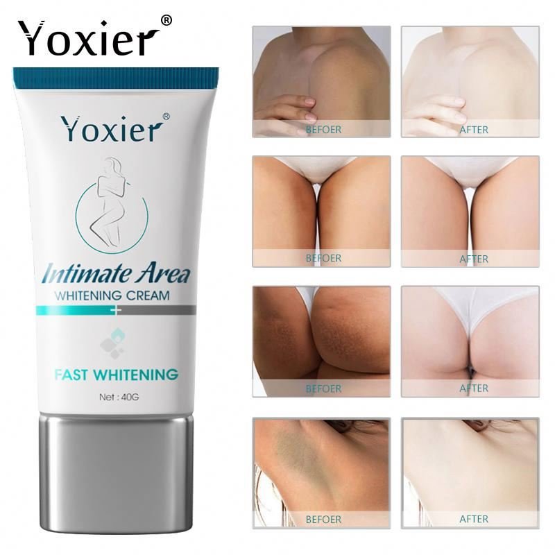 Dark Knees And Elbows Strong Whitening Cream Fast Action Whitening Cream