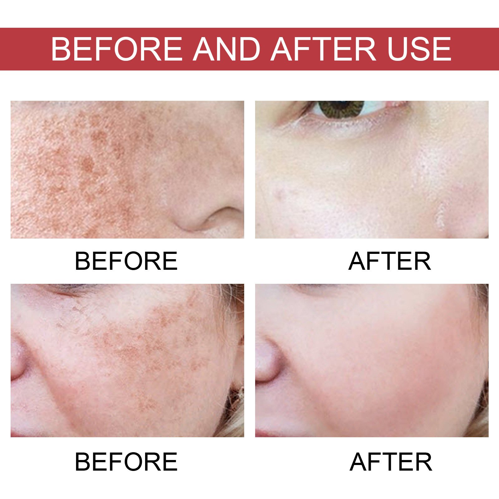 Dark Spot Correction and Repair Essence Brightening Repair Essence wholesale price