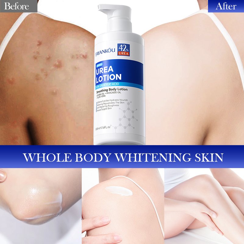 FAYANKOU Adult Women Body Lotion 42% Urea 2% Salicylic Acid Moisturizing Nourishing Soothing Drying Skin Whitening Body Lotion