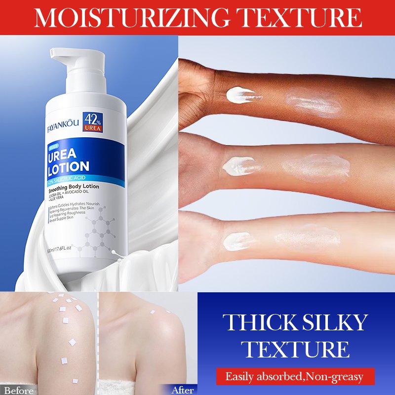 FAYANKOU Adult Women Body Lotion 42% Urea 2% Salicylic Acid Moisturizing Nourishing Soothing Drying Skin Whitening Body Lotion