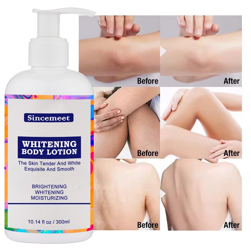 The Best-Selling And Most Effective Skin-Moisturizing And Whitening Body And Facial Lotion In South Korea In 2024