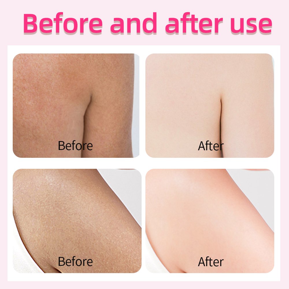 Wholesale African women skin care bleaching cream for body