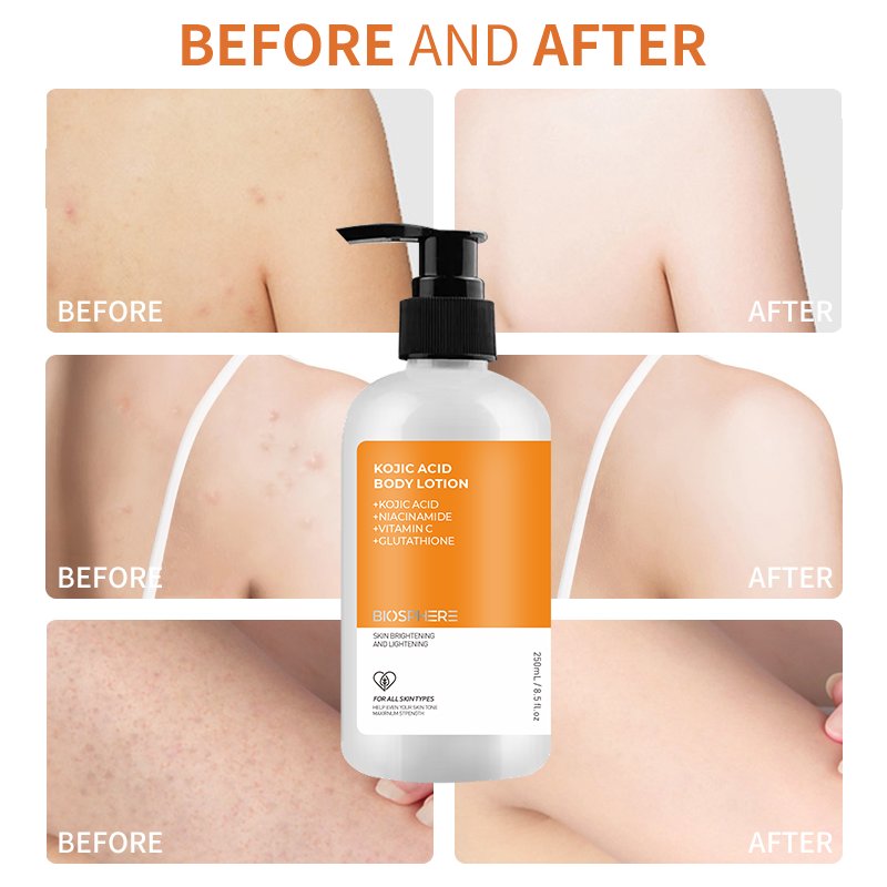Beauty Factory Organic Vitamin C Private Label Moisturizing Brightening Fast Skin Whitening Kojic Acid Body Lotion For Women