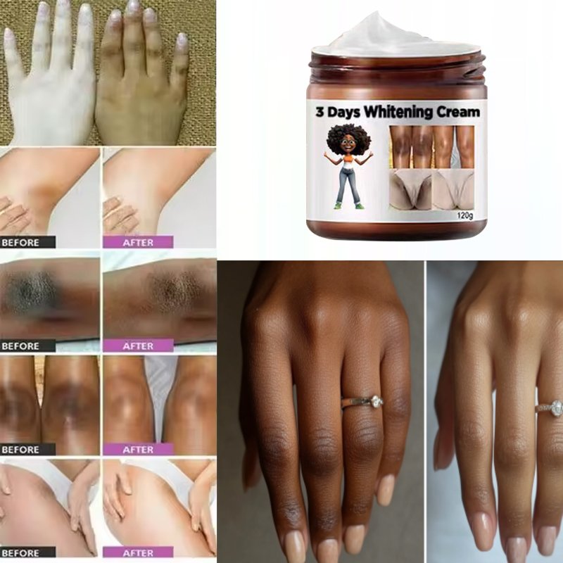 Arbutin Licorice Extract body care,Armpits Knees Joints Hips,Dark skin best 3 days fast Female private parts whitening cream