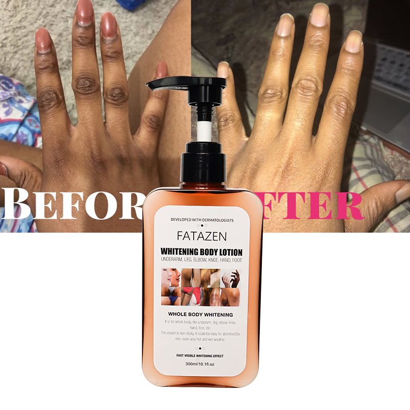 FATZEN Skin Care Products Organic Arbutin Skin Whitening Exfoliating Cream Anti Dark Spot Moisturizing Whitening Body Lotion