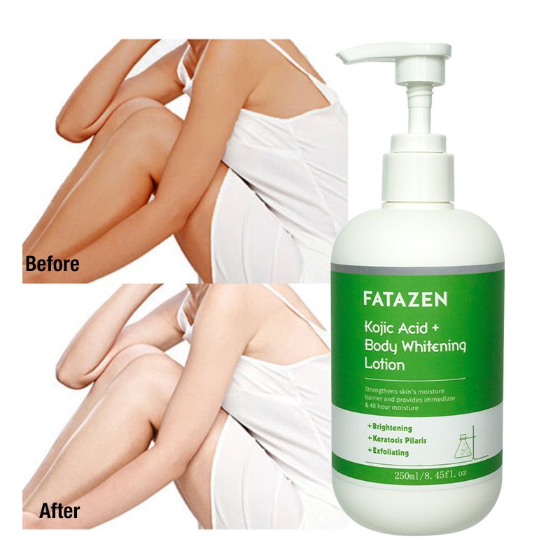 OEM Kojic Acid Lotion Whitening Body Cream Repair Exfoliating Dark Spot Removing Moisturizing Kojic Acid Whitening Body Lotion