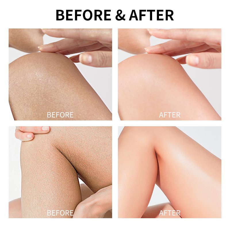 Cosmetics Manufacturer Antioxidant Anti Aging Custom Whitening Hyaluronic Acid Body Brightening Glutathione New Skin Care Set