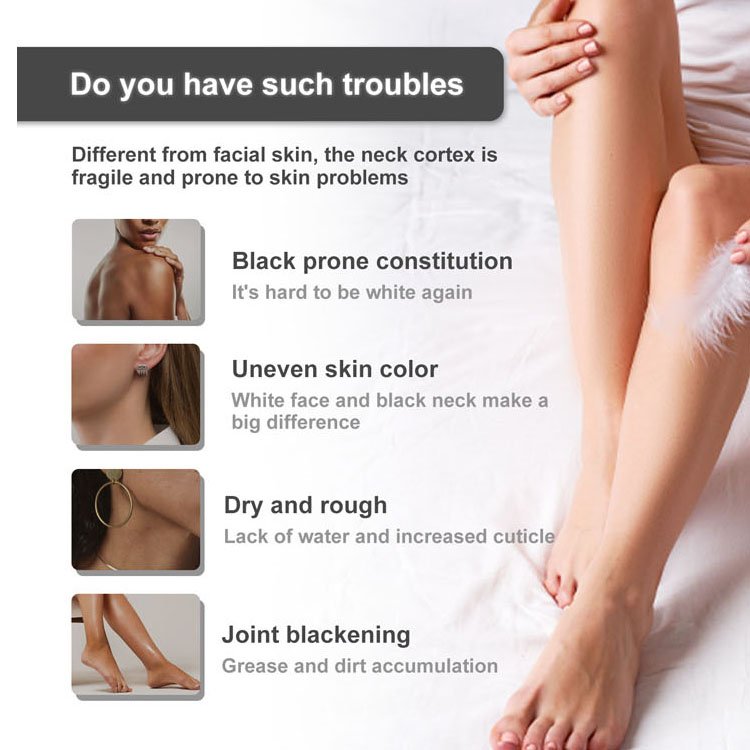 Organic Body Lotion Remove Spots Body Cream Best Body Lotion For Moisturizing Whitening