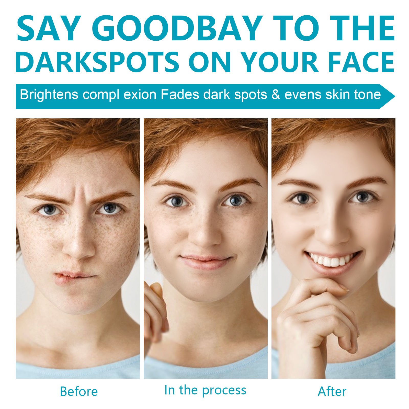 Freckles Pimples Removing Face Cream Moisturizing Whitening Body Lotion for Dark Spot Remover