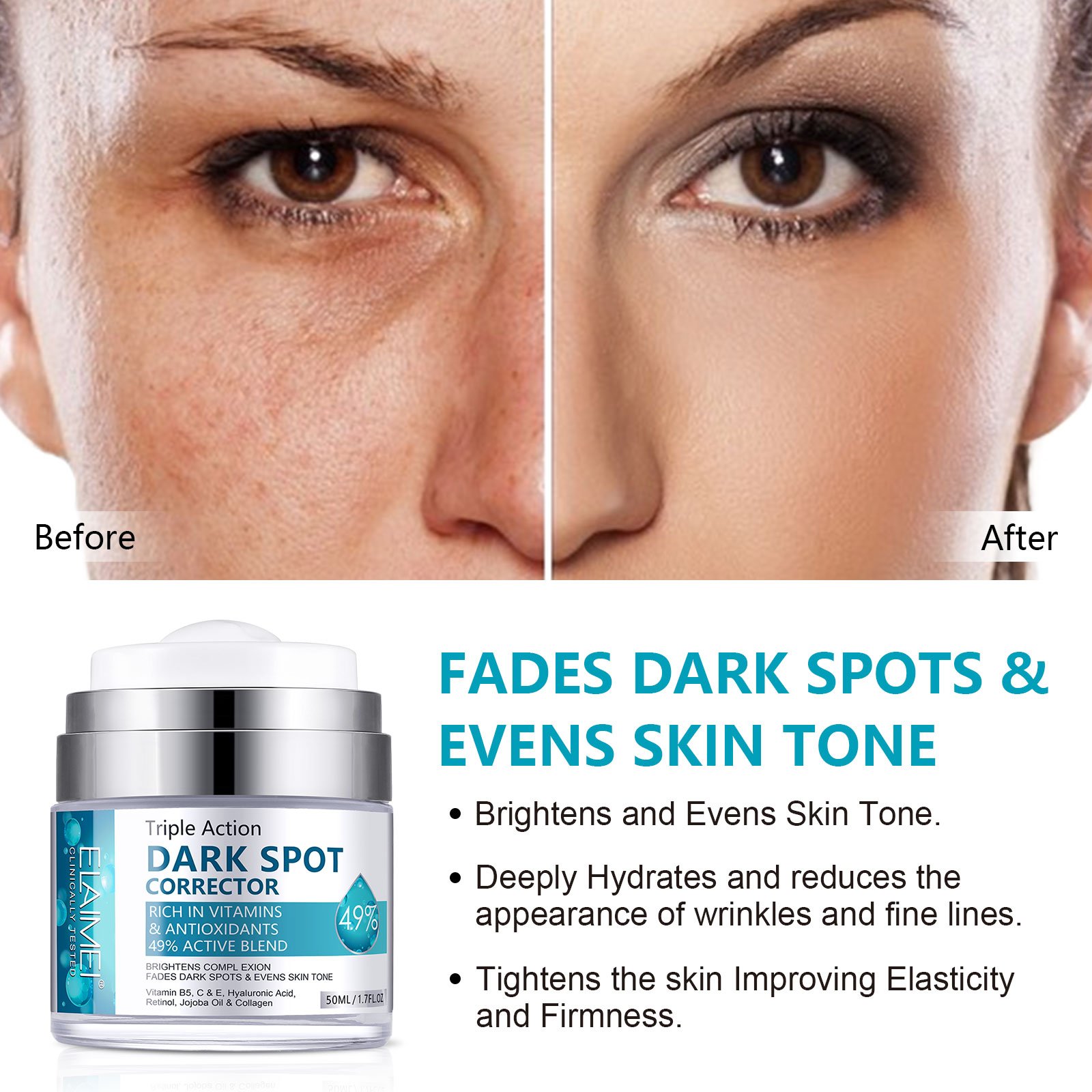 Freckles Pimples Removing Face Cream Moisturizing Whitening Body Lotion for Dark Spot Remover