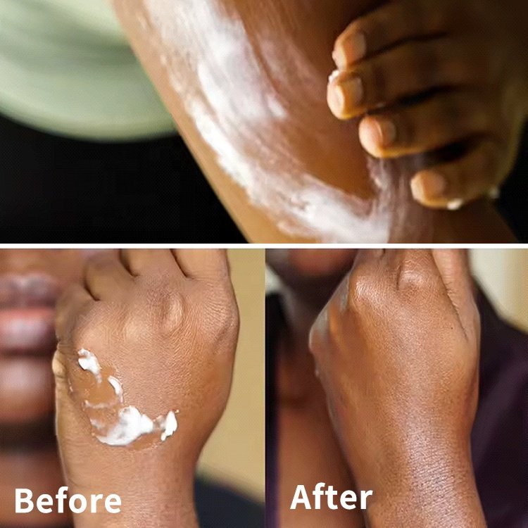 7-15 Day Arbutin Whitening Skin Care Products Removes Dark Spots Vitamine C Women Lightening Body Lotion For Black