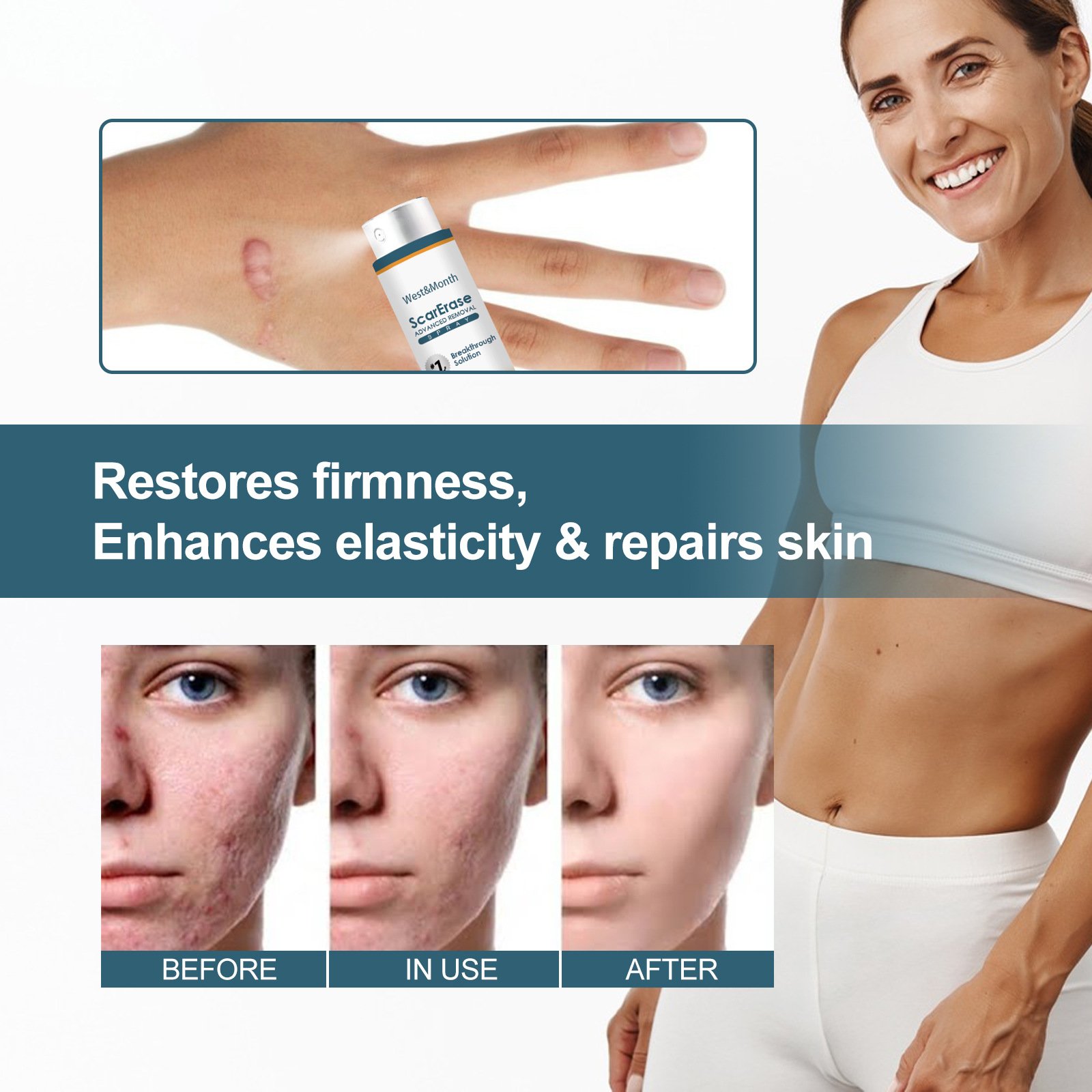 Custom logo whitening body lotion body lotion wholesale best selling body lotion Scar repair and removal of stretch marks