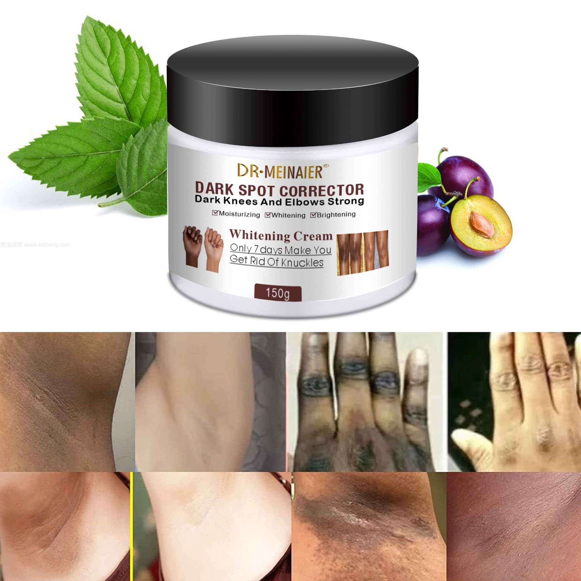 wholesale whitening face and body cream Dark Spot Remove Cream Underarms Brightening Cream Knees Elbows Dark Spot