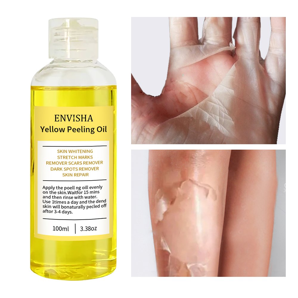 Natural African Strong Bleaching Oil Dark Knees Knuckles Skin Removal Oil Skin Whitening Yellow Orange Peeling Oil