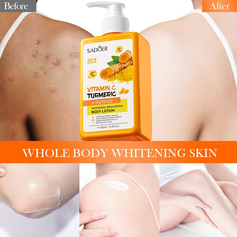 SADOER Turmeric Vitamin C Body Cream Retinol High Moisturizing Whitening Body Lotion 300ML