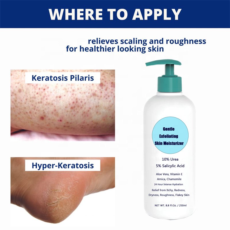 Moisturizer Psoriasis Body Lotion For Itchy Dryness Relief, with 10%Urea 5%Salicylic Acid 24H Intense Hydration Skin Body Cream