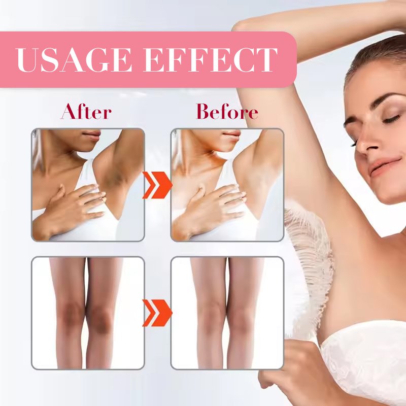 ALCAROL Whitening Cream For Armpit Knees Anti Dark Spot Moisturizing Whitening Body Lotion Sensitive Areas and Private Parts