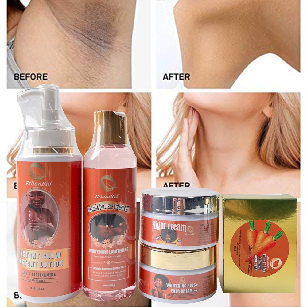 Whitening Skin care Glutathione Lightening Dark Skin Lotion Remove dark spots anti-aging treatment acne whitening set