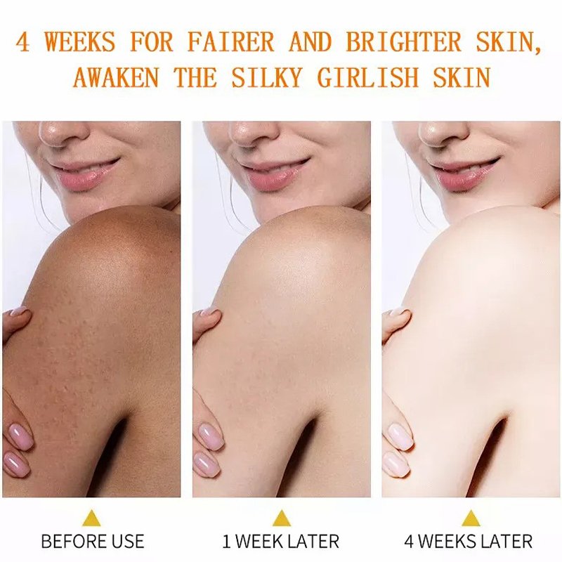 DR.DAVEY Kojic Acid Body Lotion Whitening Lightening Body Lotion For All Skin