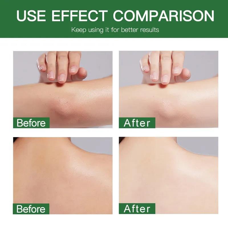 Factory Sales 300g Skin Care Moisturizing Brightens Skin Tone Niacinamide Hydrating Body Lotion