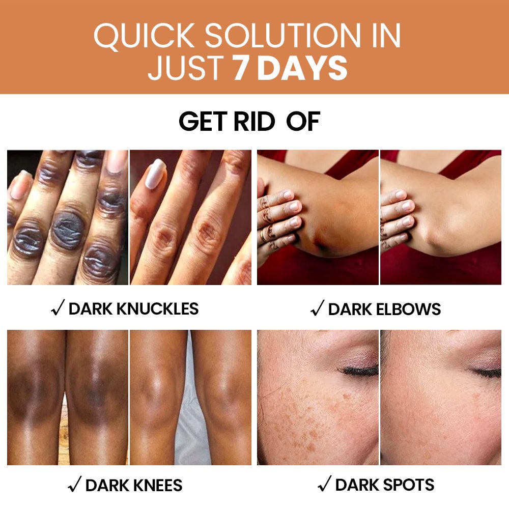 Private Label Skin Whitening Body Cream Strong Bleaching Products Dark Spots Remover Lightening Body Lotion Adults Female