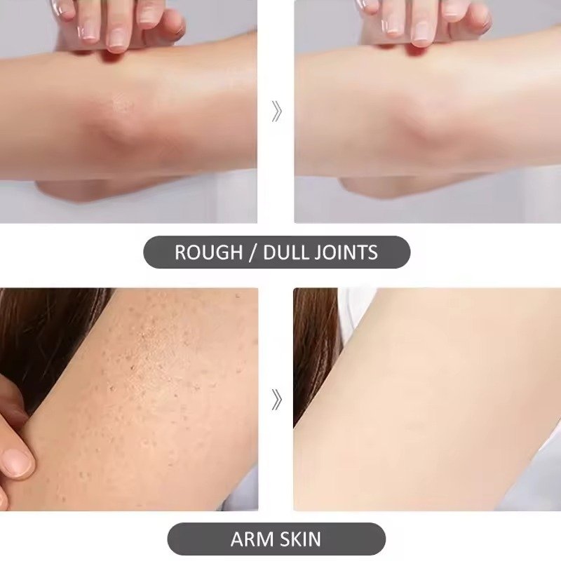 OEM ODM Strong Bleaching Cream Skin Vitamin C Whitening Body Lotion Fast Effective Brightening Dead Skin Removal