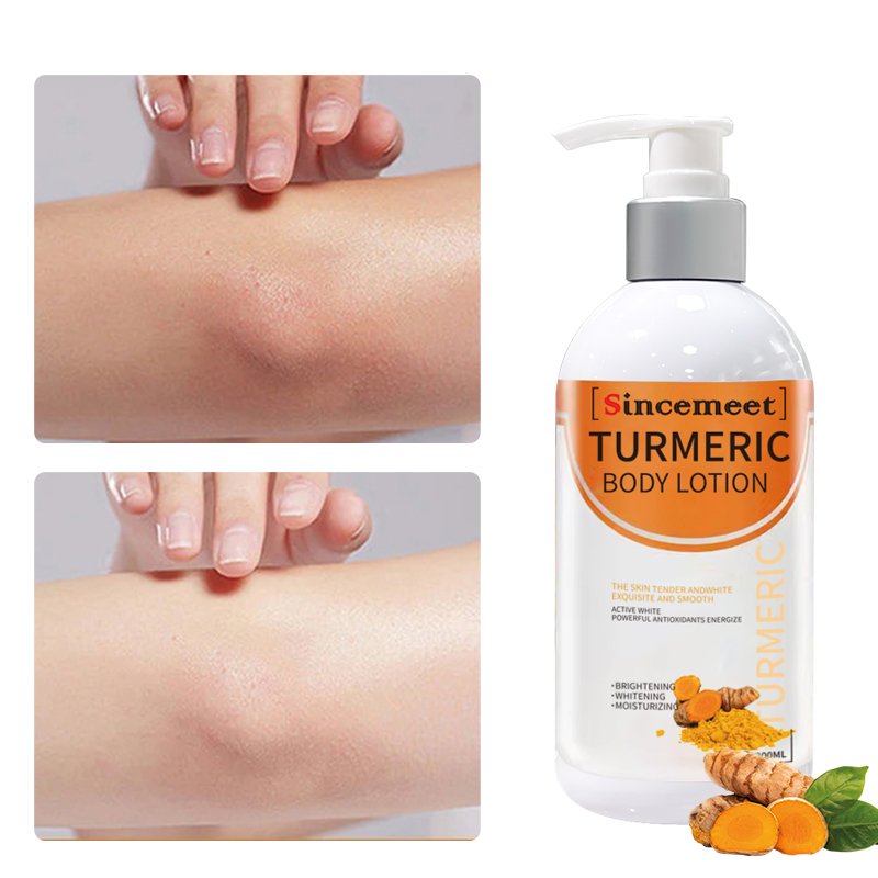 Custom Fragrance Black Skin Brightening Spot Removal Lightening Dark Skin Bleaching Cream Turmeric Body Whitening Lotion