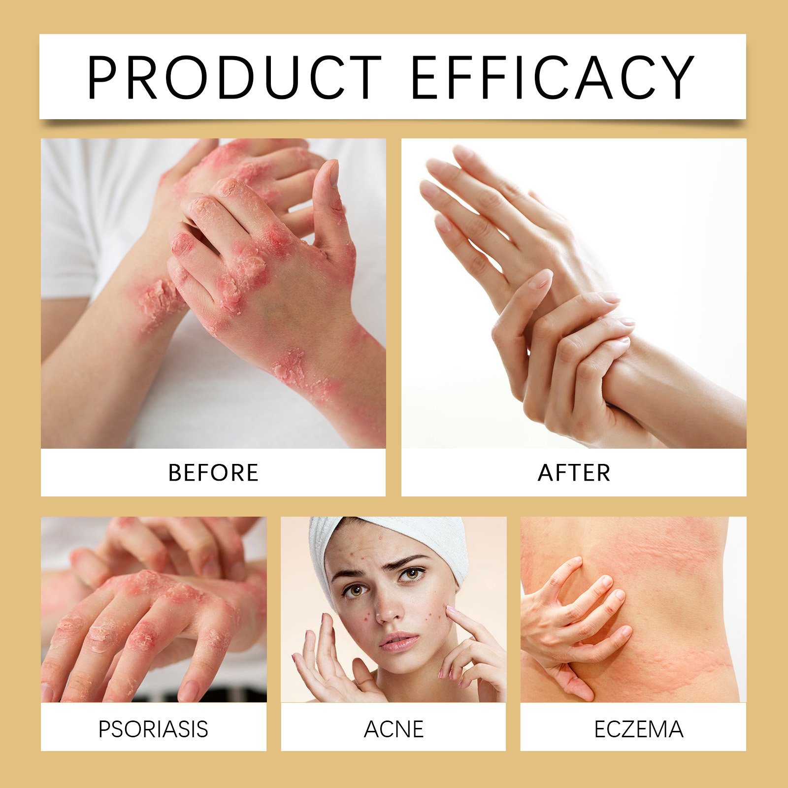 OEM Private Label 100% Natural Baby Cream Moisturizing Cream 250ml Vitamin B5 Face & Body Eczema Cream
