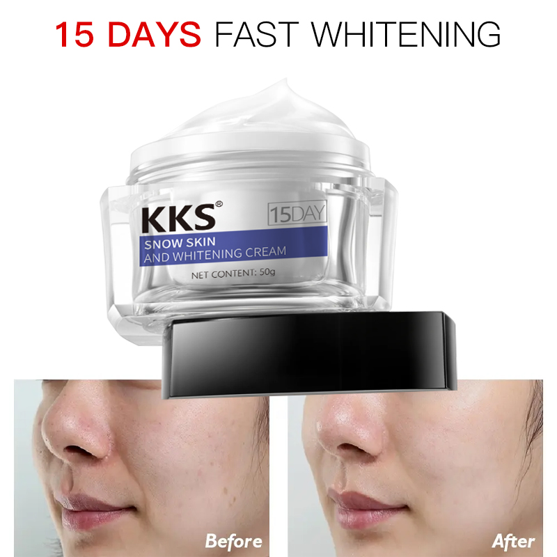 Skin whitening face night cream for sensitive skin Strong Lightening Bleaching Face Cream Body Dark Skin 15 Days Whitening Cream