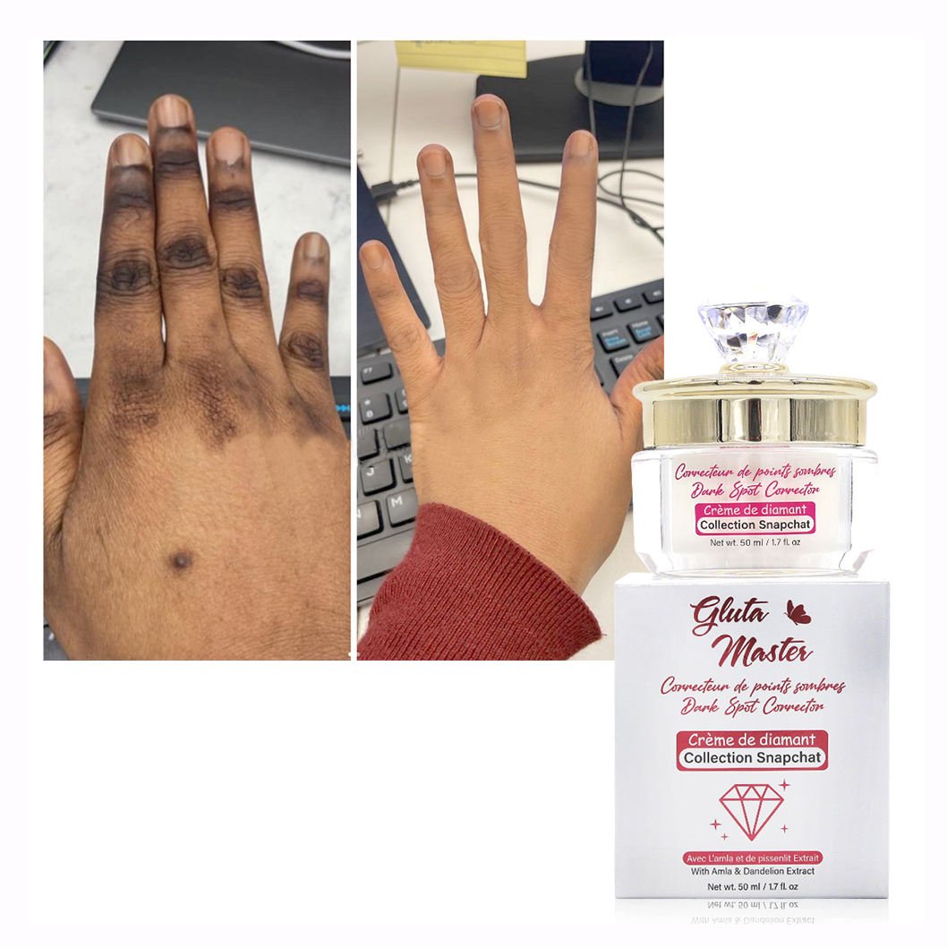 OEM Diamond Face Cream Brightening Vitamin C Anti-Aging Dark Spots Remover Correcting Body Black Skin Whitening Face Cream