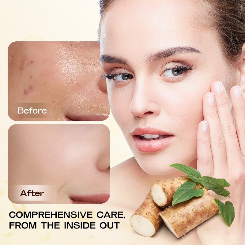 Private Label Skincare Wild Yam Moisturizes Whitening And Brightening Nourishes And Rejuvenates Skin Tone-up Wild Yam Face Cream