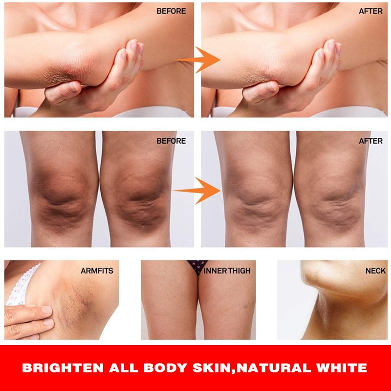 Private Label Extreme Anti Dark Spot Aging Wrinkle Knees Elbows Strong Vitamin White Lotion Face Cream Body Cream