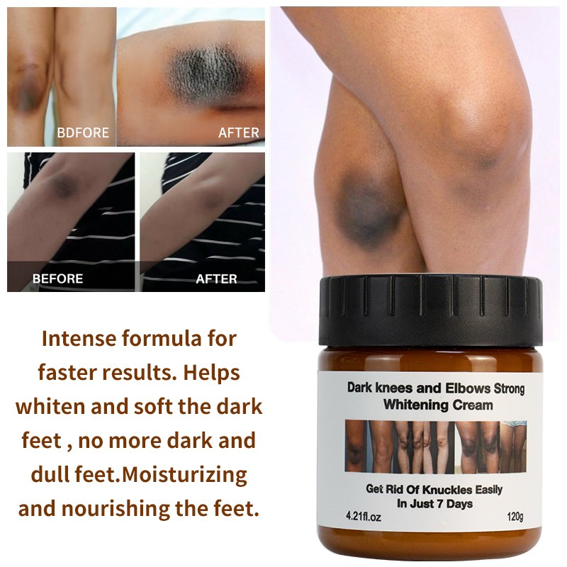 Private Label Extreme Anti Dark Spot Aging Wrinkle Knees Elbows Strong Vitamin White Lotion Face Cream Body Cream