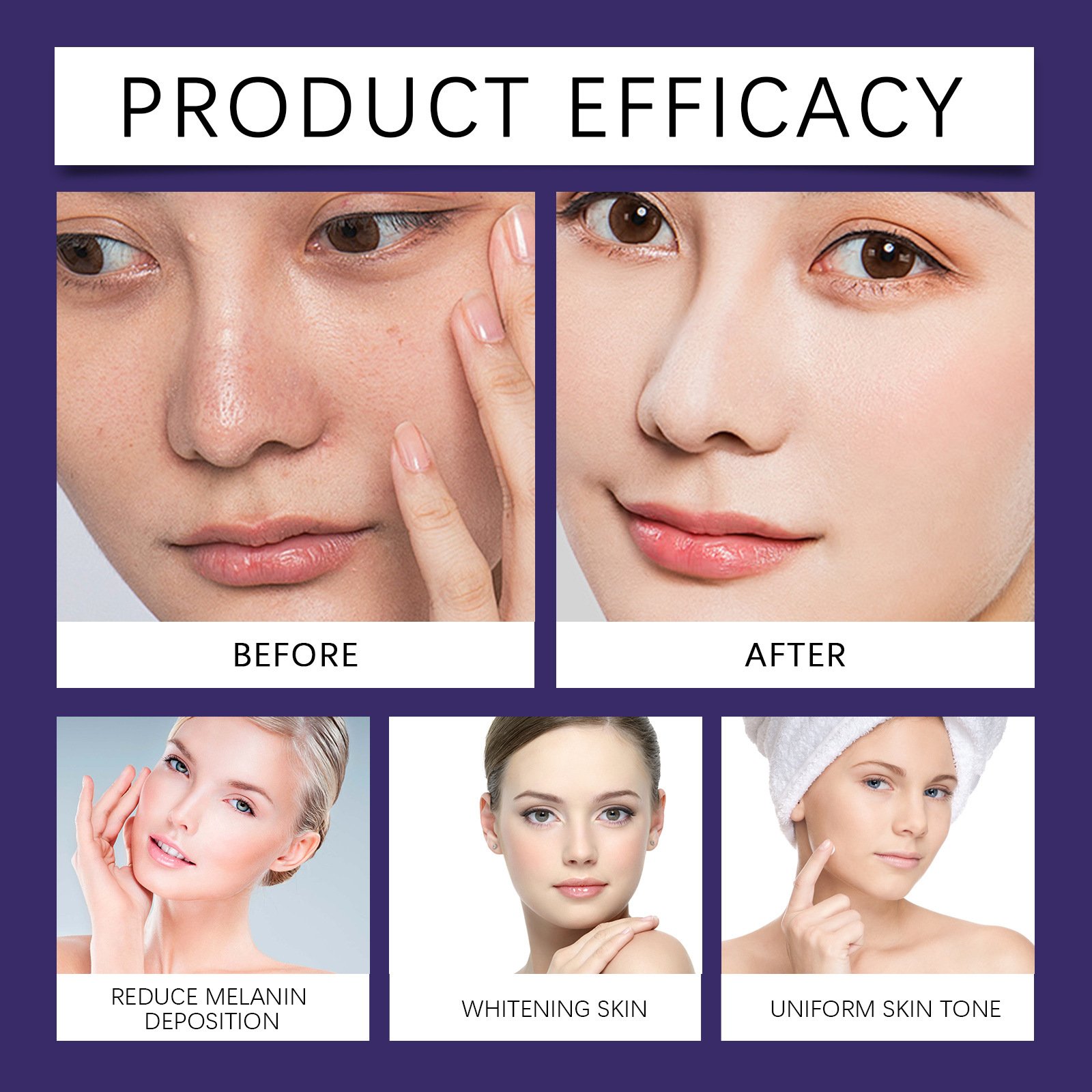 Hoygi Remove Face Dark Spot Corrector Remover Whitening Cream Skin Care Moisturizer Facial Cream Intimate Dark Spot Cream