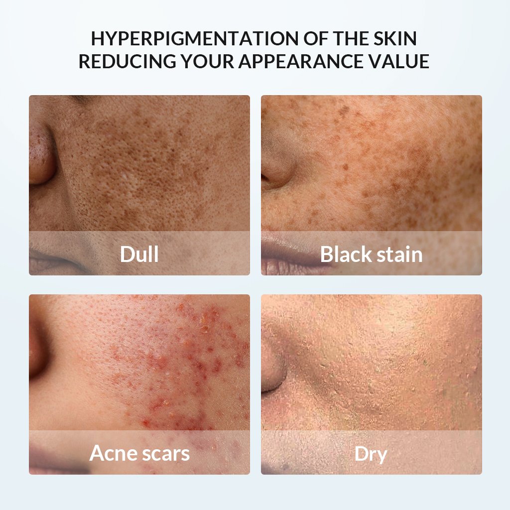 Biosphere Private Label Cosmetics Care Freckle Removing Facial Cream Lotion moisturizer Whitening Tone Up Face Cream