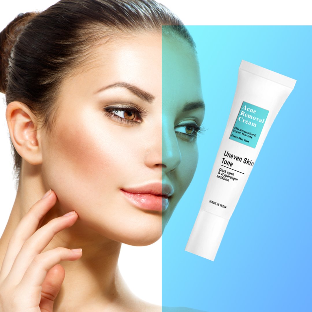 DARK SPOT REMOVAL ANTI ACNE BEST FACE CREAM OEM ODM