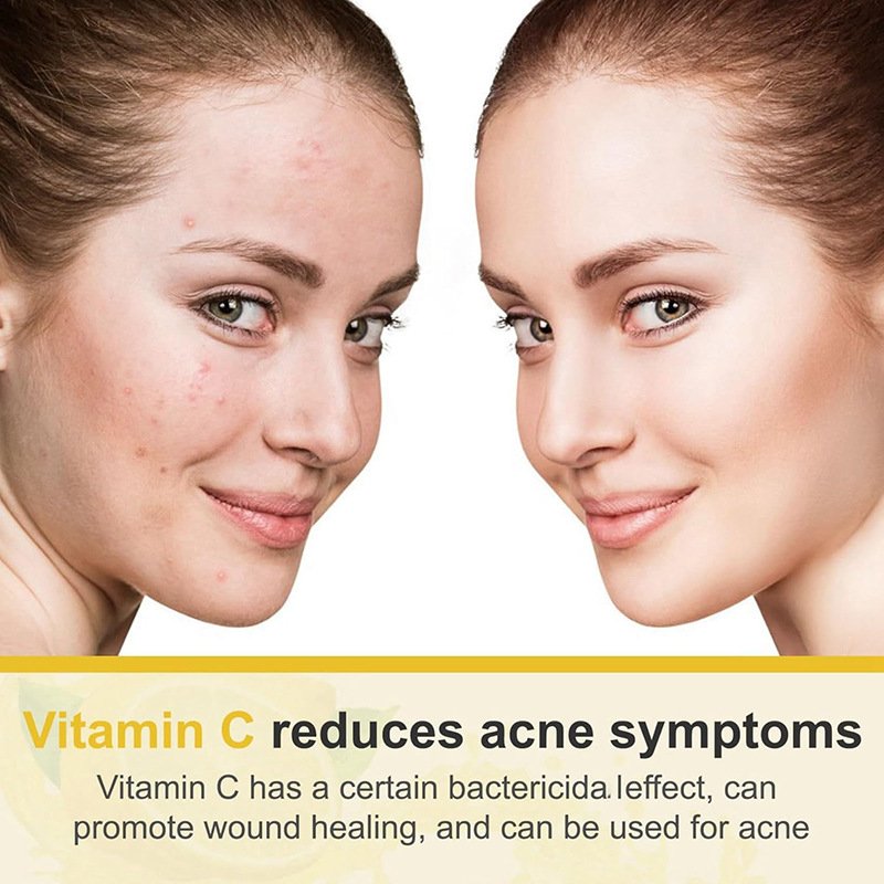 OEM customized 50ml/bottle Firming Moisturizing and brightening vitamin VC face cream for women facial care