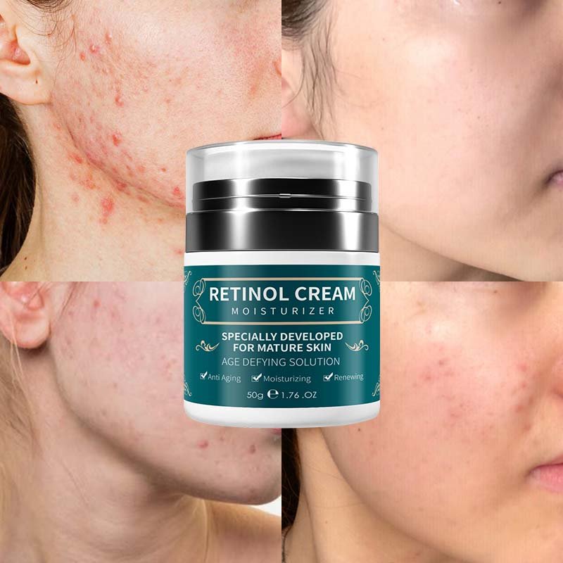 Hot Sale Oem Private Label Korean Retinol Face Cream Whitening Skin Collagen Moisturizer Night Retinol Cream