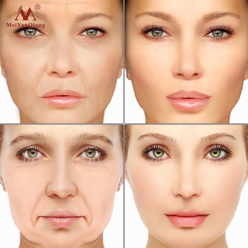 Face Lifting Facial Cream Anti Wrinkle Anti Aging Cream Hydrating Moisturizer Anti Spot Whitening Face Cream